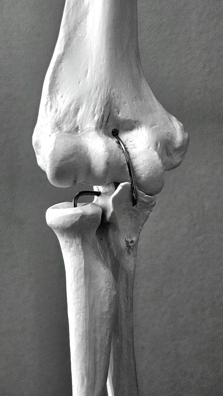 A detailed black and white view of the human knee joint anatomical model showcasing bone and ligament structures.